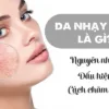 Da nhạy cảm là gì? Nguyên nhân, dấu hiệu và cách chăm sóc