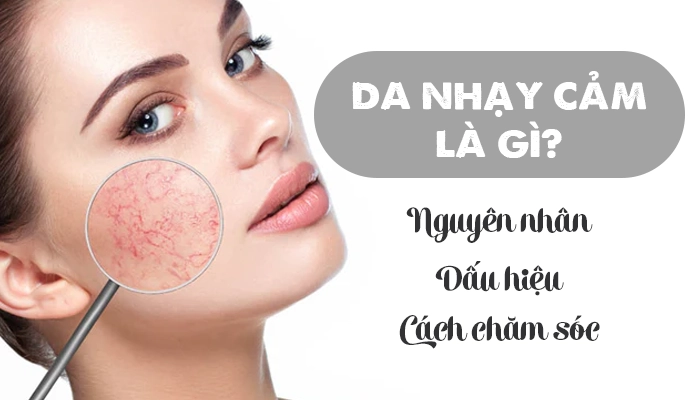 Da nhạy cảm là gì? Nguyên nhân, dấu hiệu và cách chăm sóc