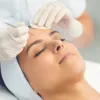 Mụn Đầu Đinh: Dấu Hiệu Nhận Biết Và Cách Xử Lý Kịp Thời