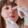 Mụn viêm kết hợp là gì? Cách điều trị tổng thể từ trong ra ngoài